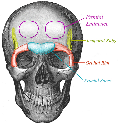 FFS forehead bones